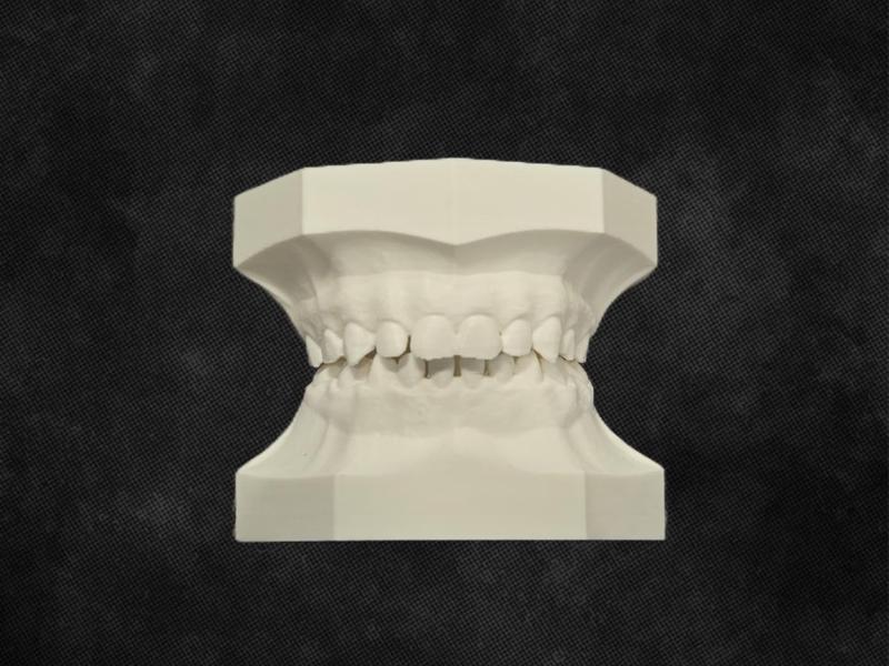 Pediatric Dental Typodont - Anatomically Correct