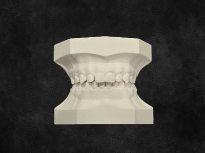 Pediatric Dental Typodont - Anatomically Correct