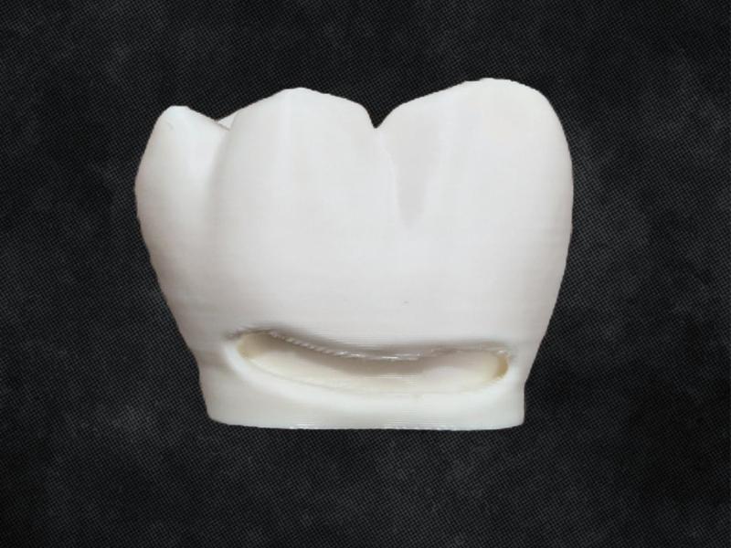 Tooth Preparation Model - Class 5 Filling LR