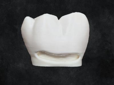 Tooth Preparation Model - Class 5 Filling LR