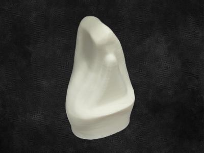 Tooth Preparation Model - Class 4 Upper Anterior