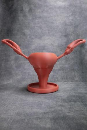 Uterus Pot (Pre Supported)
