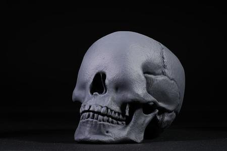 Blind Skull (Pre Supported)