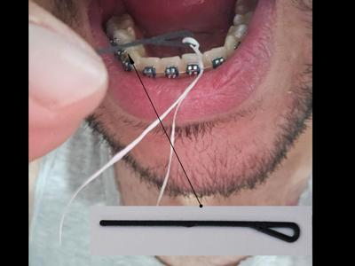 Dental floss threader for orthodontic braces
