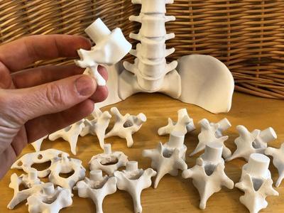Vertebral Stacking Blocks