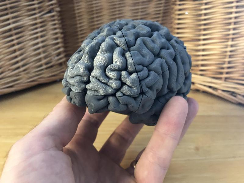 Brain Teaser