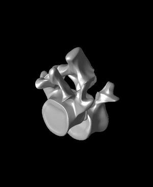 Spondy a high grade pathology model bennett