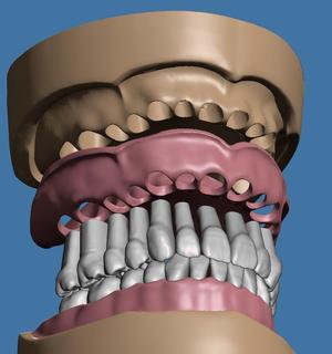 Dental model maxillary and mandibular with soft tissue version 3D Model Collection