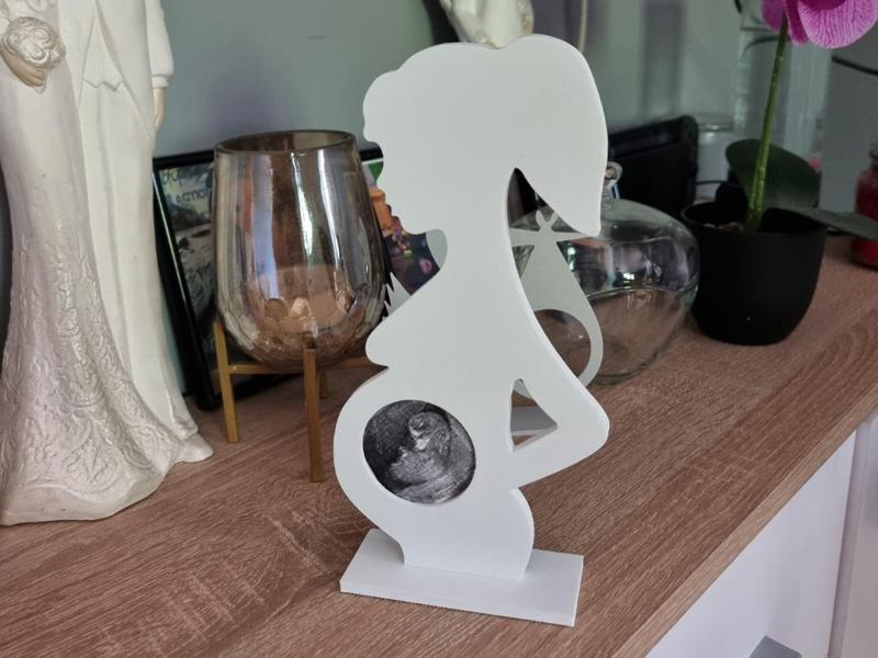 Ultrasound Picture Frame