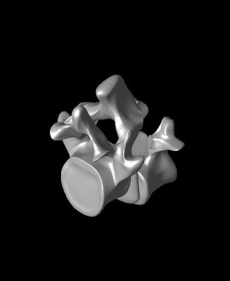 Spondy grade 2 listhesis  bennett model.stl