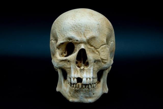 One-Eyed Willy Skull from Goonies