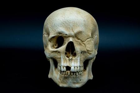 One-Eyed Willy Skull from Goonies