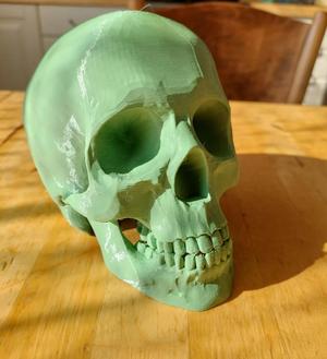 Human Skull
