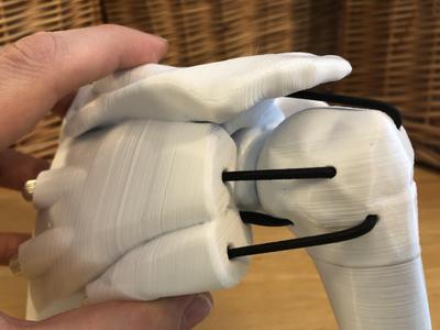 Dynamic Shoulder Rotator Cuff Education Model
