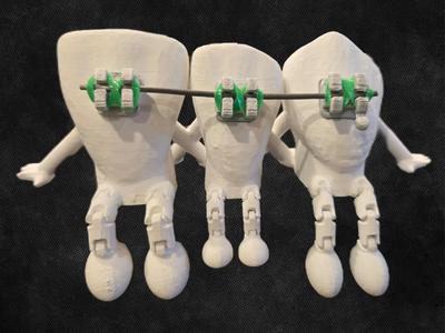 Toothie Buddy - Incisor lateral canine +/- braces