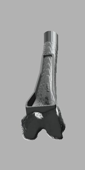 Distal Femur IO Trainer