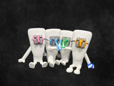 Crowded Lower Incisor Tooth Buddy with Braces