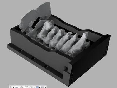 1-OccipitoCervicalPosterior Model 1   