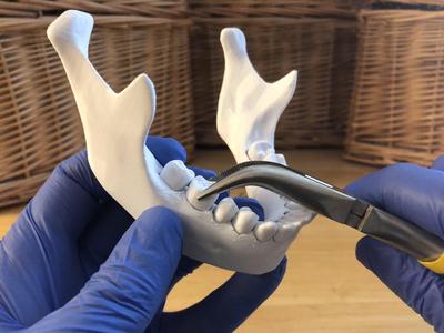 Loose Teeth