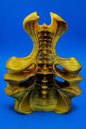 Vessel (Pre Supported)