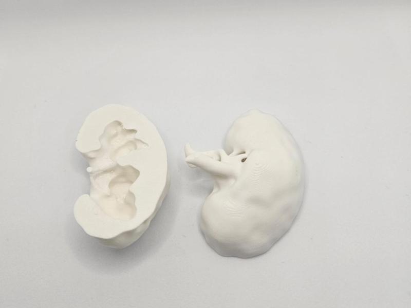 Left Kidney anatomical model (CT Scan)