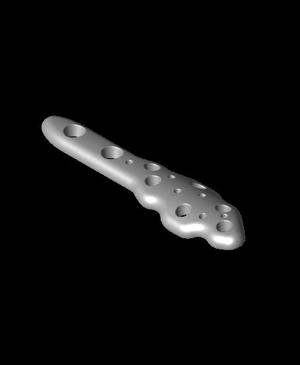 Distal Fibula.stl