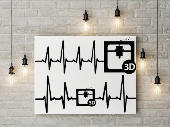 Heart Beat 3D printer  2D