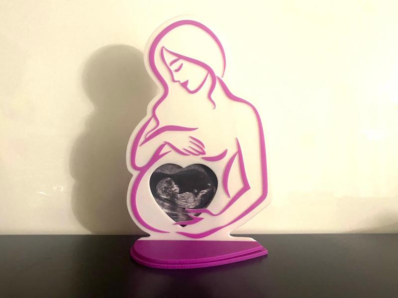 Ultrasound photo frame