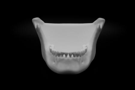 Human Jaw bowl (Pre Supported)