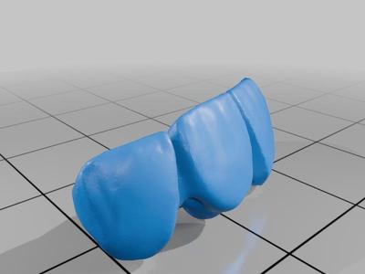 4-Unit Dental Bridge Design