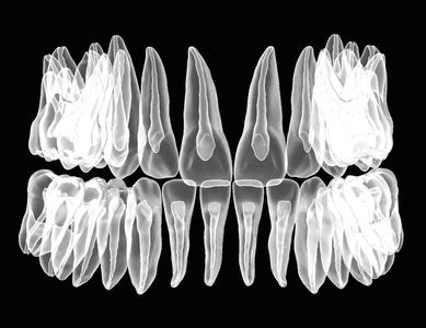 Maxillary and Mandibular teeth with pulp