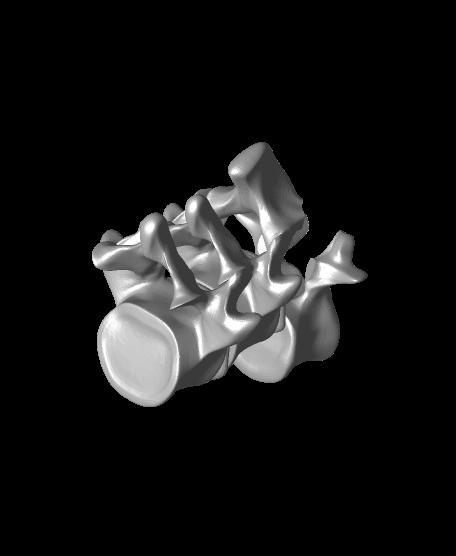 3 VB version of high grade Spondy models.stl