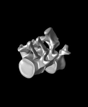 3 VB version of high grade Spondy models.stl