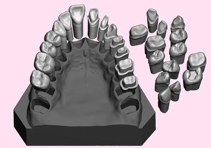 Full die set dental sample model maxillar