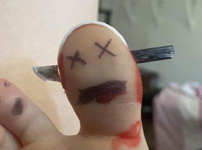 Knife Injury toeband