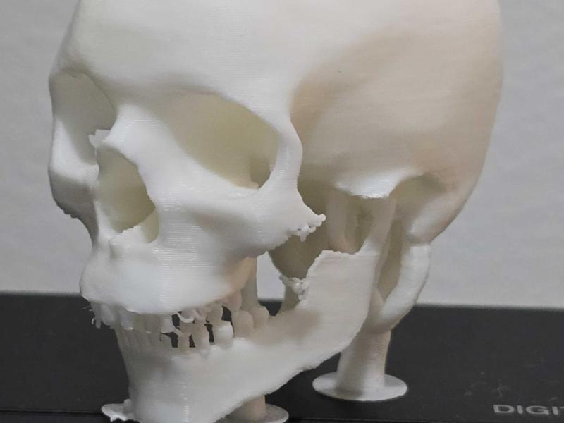 Skull