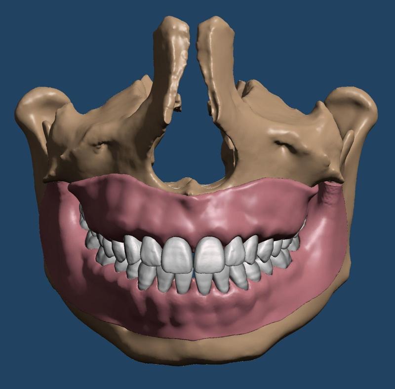 Maxillary and Mandibular dental models with anatomical teeth
