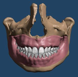 Maxillary and Mandibular dental models with anatomical teeth