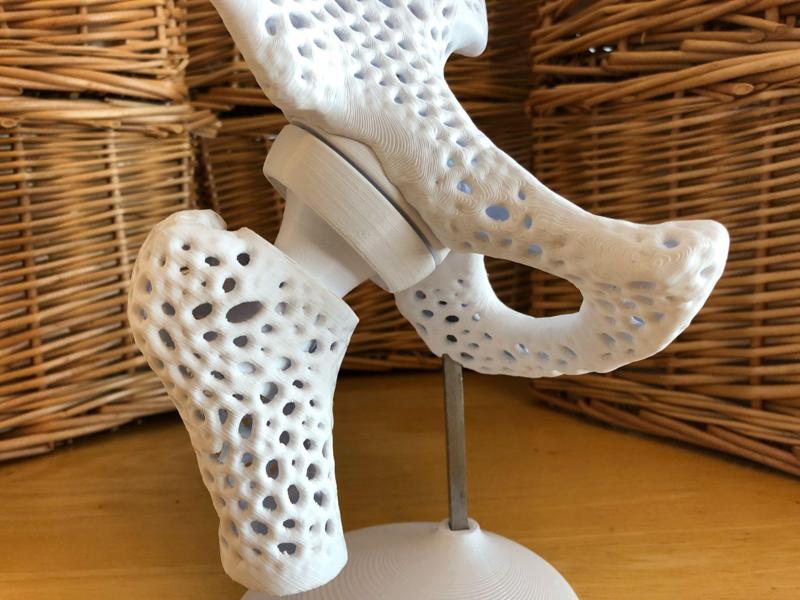 Pelvis Model with Adjustable Ball and Socket Acetabular Joint