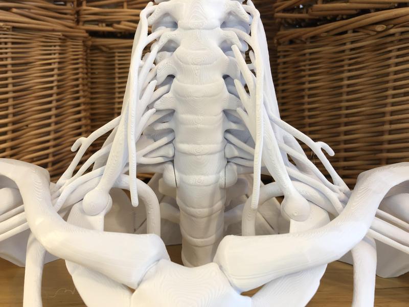 16-Piece Full Size Brachial Plexus Model