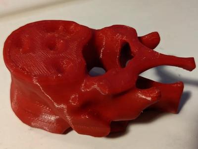 Real human spinal vertebra - from CT scan