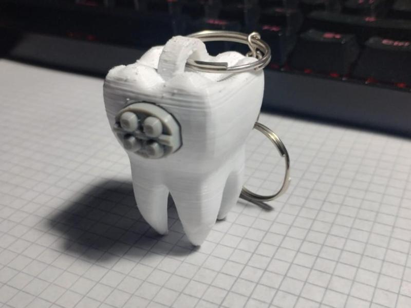 Tooth Keychain