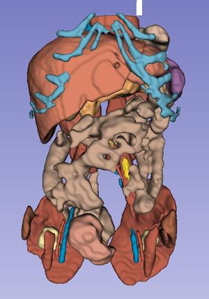 Juvenille Human Anatomy - MRI