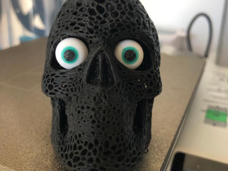 skull and brain