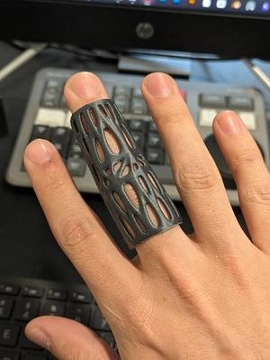 Middle finger splint/cast   
