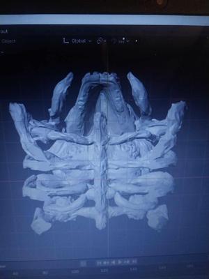 Skull.Skeleton.Spider