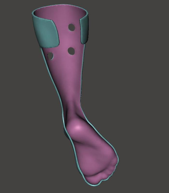 AFO - ANKLE FOOT ORTHOSIS