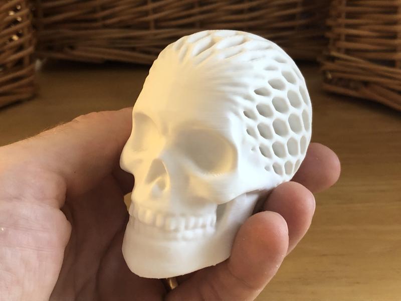 Architected Skull (Hex Honeycomb)