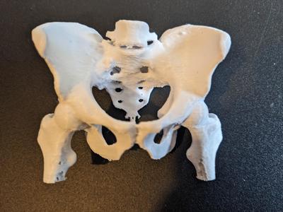 Real human pelvis - from CT scan
