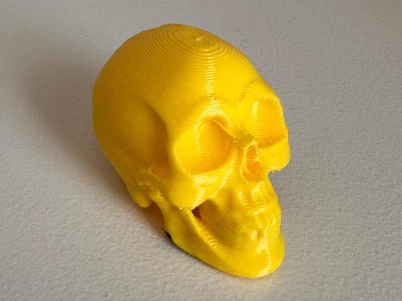 Skull